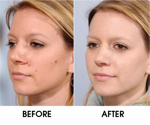 WhatsApp Image 2026 03 25 at 4.41.57 PM WhatsApp Image 2026 03 25 at 4.41.57 PM