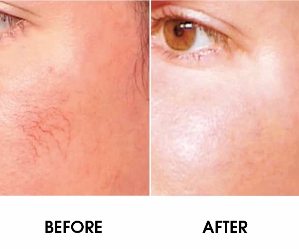 WhatsApp Image 2026 03 25 at 4.42.00 PM (1) WhatsApp Image 2026 03 25 at 4.42.00 PM (1)