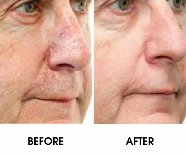 WhatsApp Image 2026 03 25 at 4.42.02 PM WhatsApp Image 2026 03 25 at 4.42.02 PM