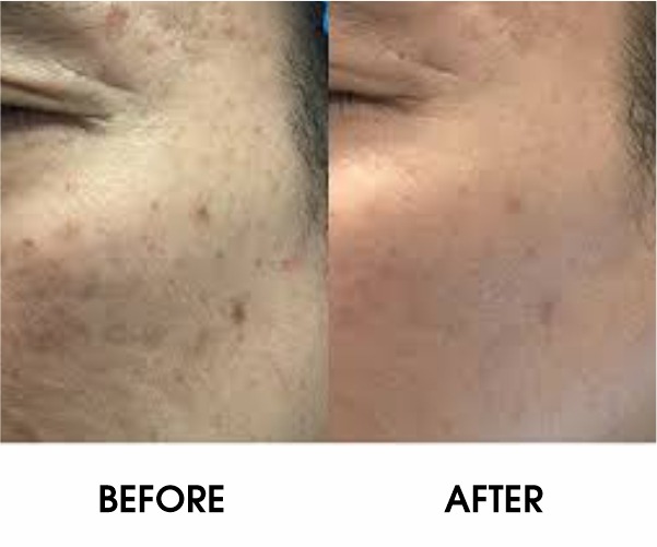 WhatsApp Image 2026 03 25 at 4.42.04 PM WhatsApp Image 2026 03 25 at 4.42.04 PM