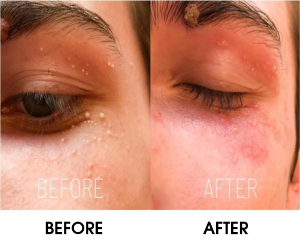 WhatsApp Image 2026 03 25 at 4.42.05 PM WhatsApp Image 2026 03 25 at 4.42.05 PM