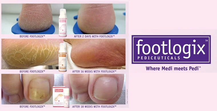 Footlogix Pedicures