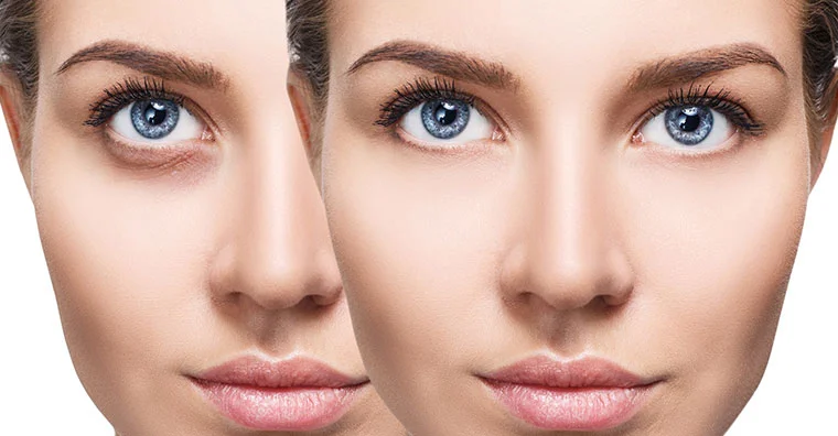 facials in orlando florida